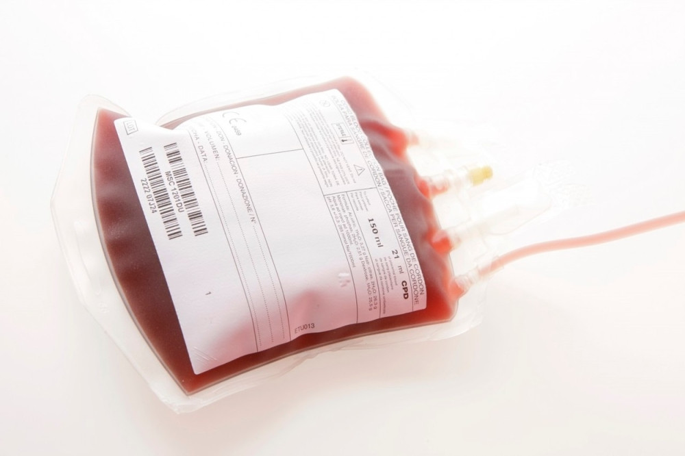 Transfuzija u Srbiji bezbedna koliko i u ostalim zemljama