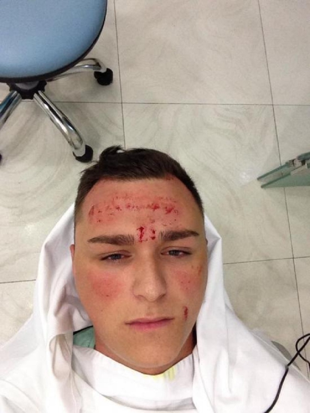 Aleksa na krvavom tretmanu! (FOTO+VIDEO)