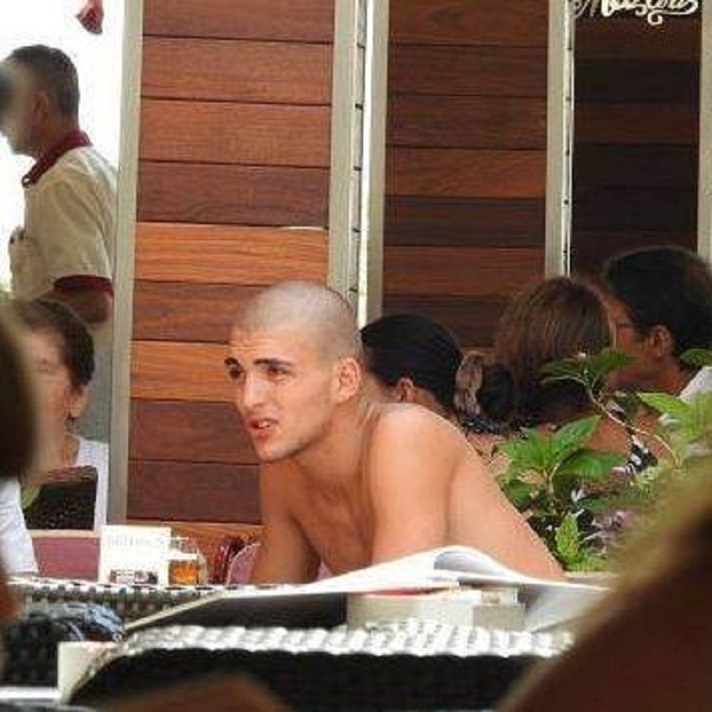 Veljko povredio glavu!