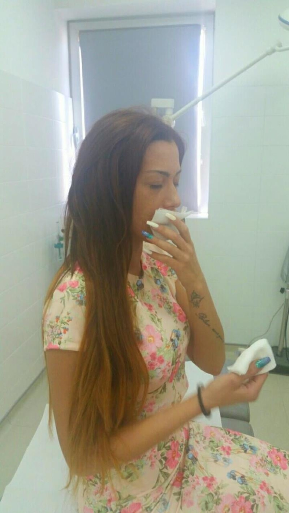 FOTO~Mimi Oro izvadila silikone iz usana!