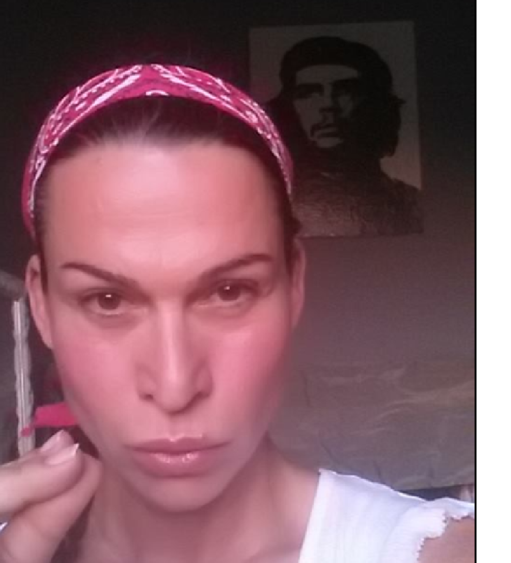 Jelena Maćić pokazala nacrtane modrice (FOTO)