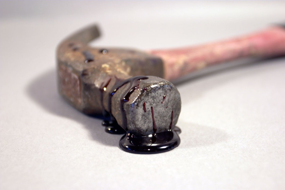 Čoveka pretukli čekićem i odsekli mu prst!