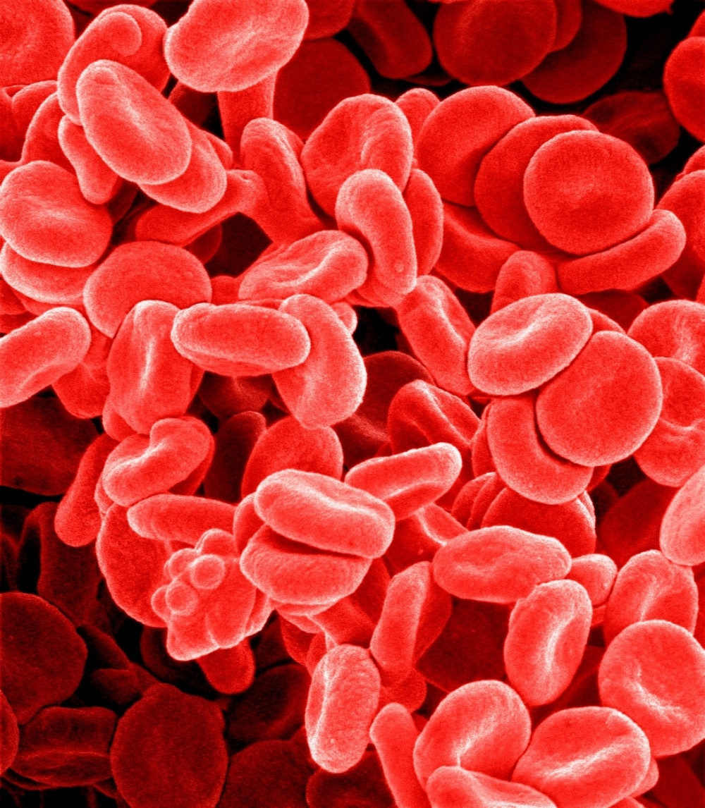 Krvna grupa otkriva kojim bolestima ste skloni!