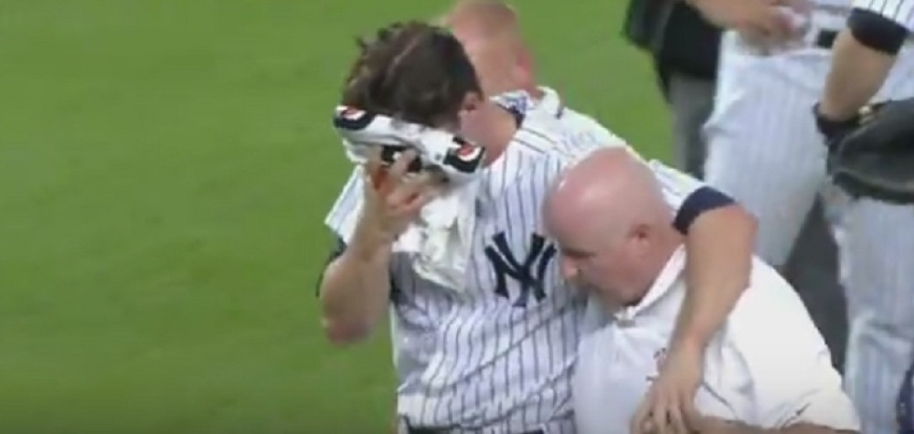 I bejzbol može da bude opasan! (VIDEO)