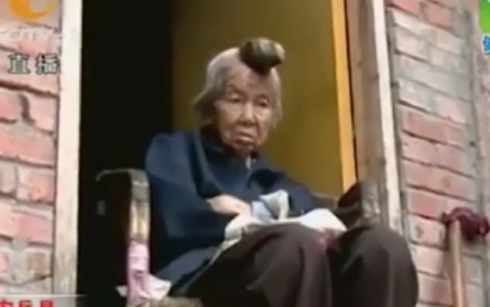 Baki raste rog iz glave! (UZNEMIRUJUĆI VIDEO)