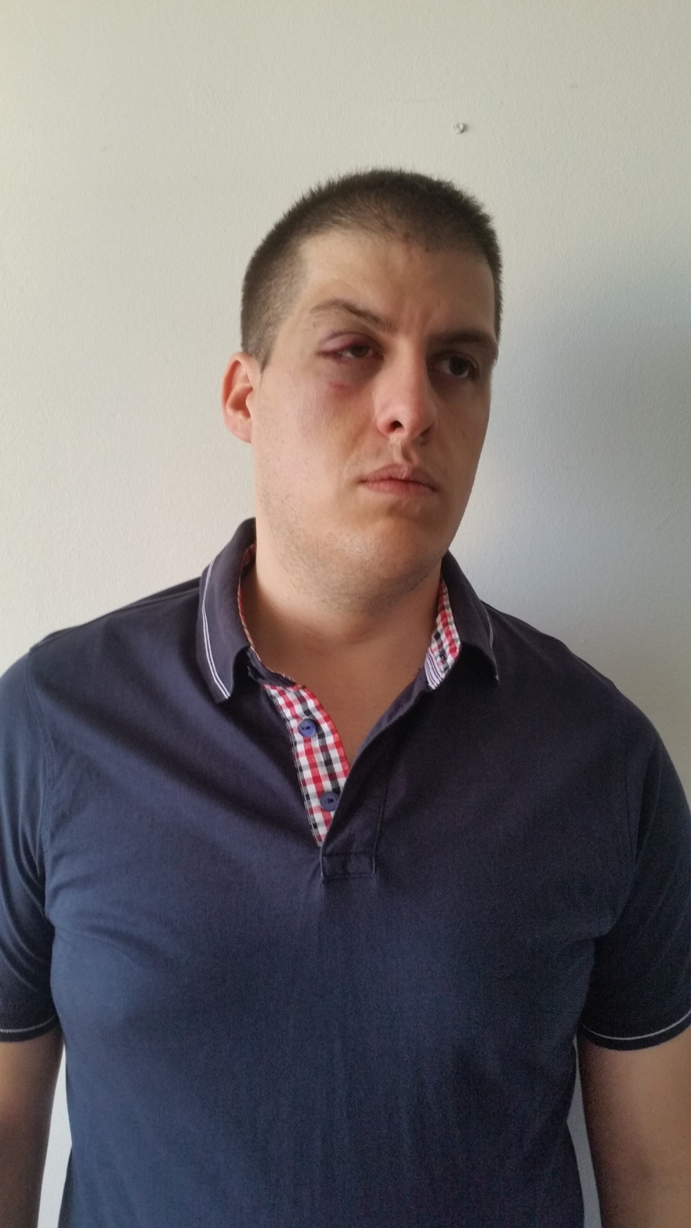 Premlaćen novinar u Beogradu