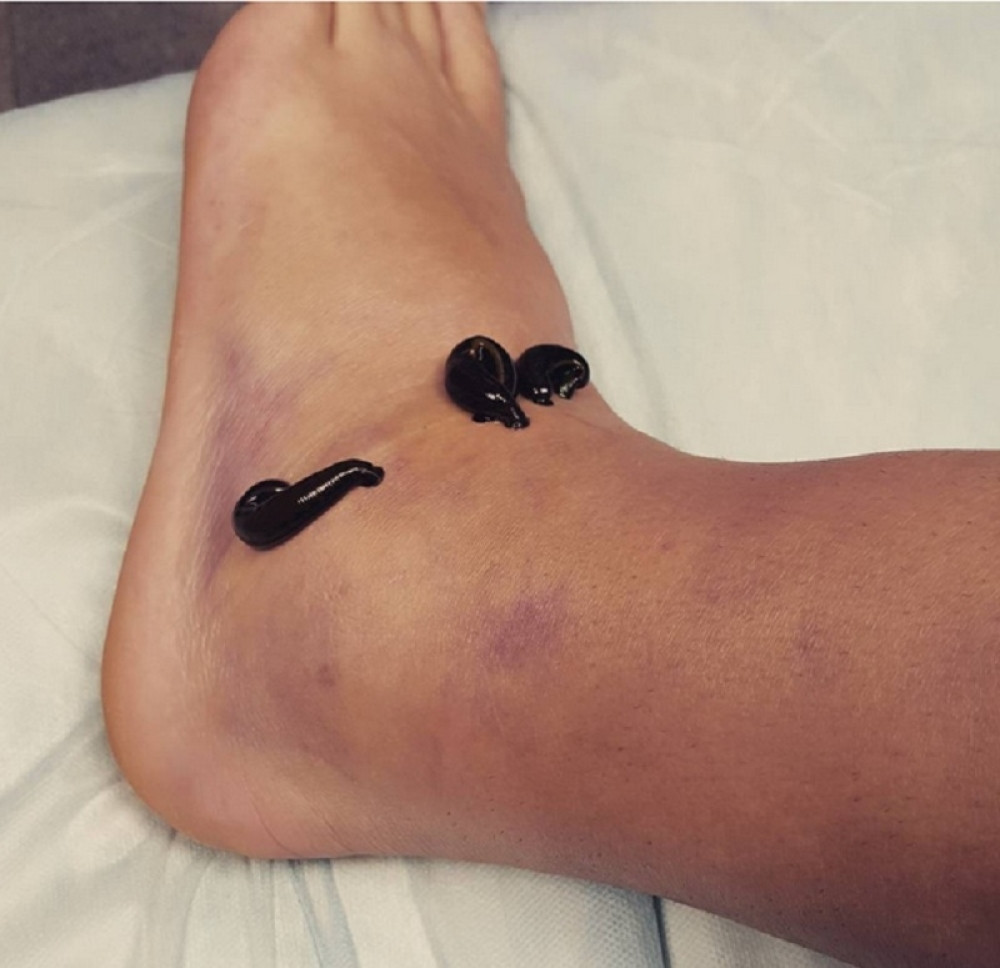 Božinov u epizodi: Pijavice vidaju rane! (FOTO)