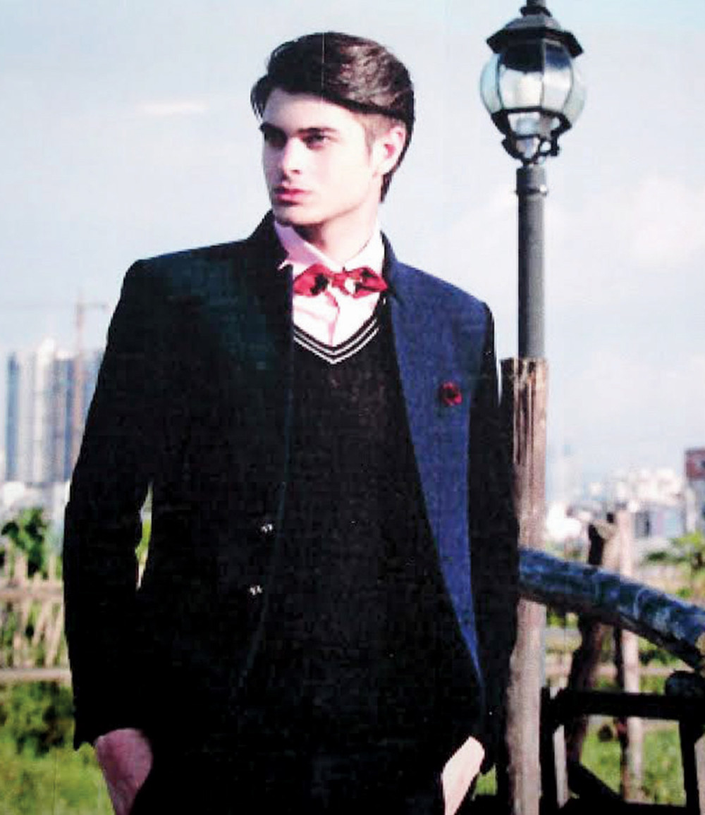 Maneken slomio nogu bežeći od razbojnika