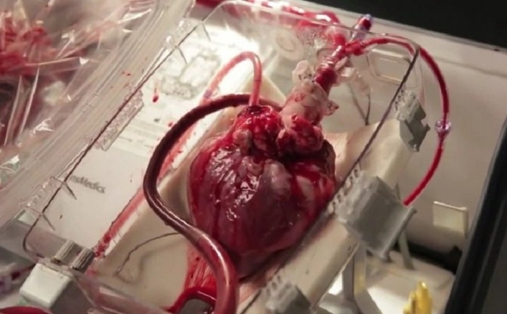 IS se bavi trgovinom organa zarobljenika