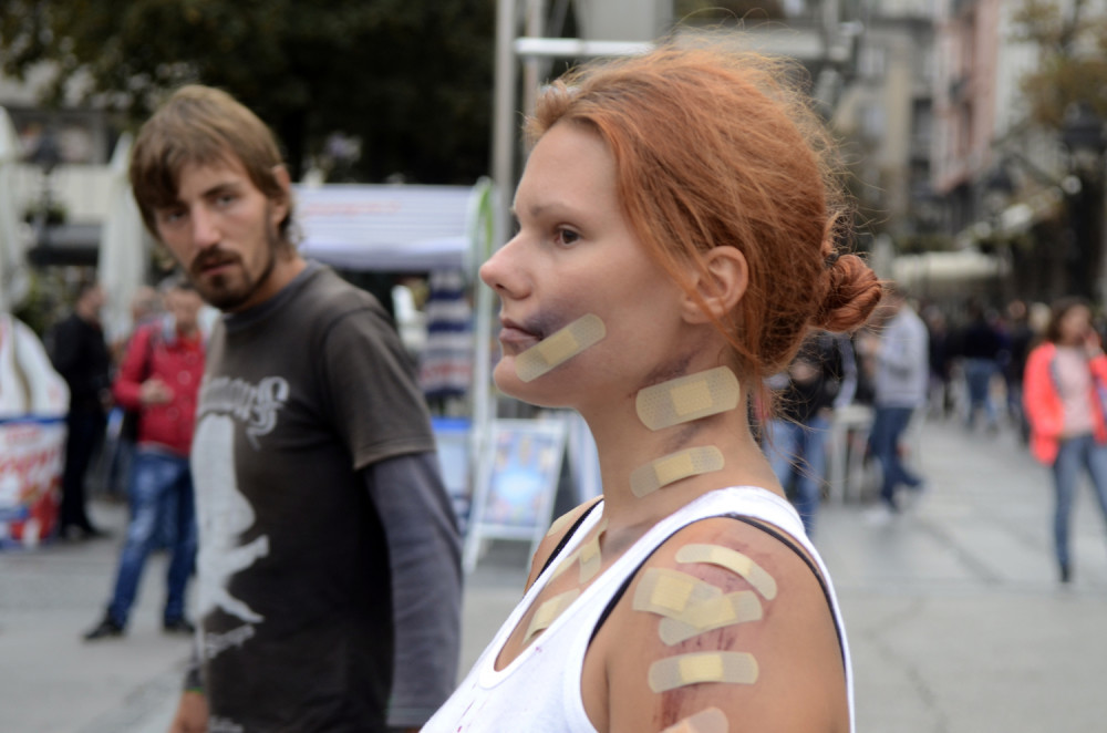 Devojka prekrivena ranama stoji na Trgu republike