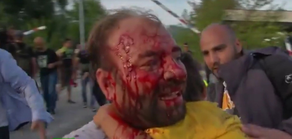 Sijarto: Žao nam je zbog povređenih srpskih novinara