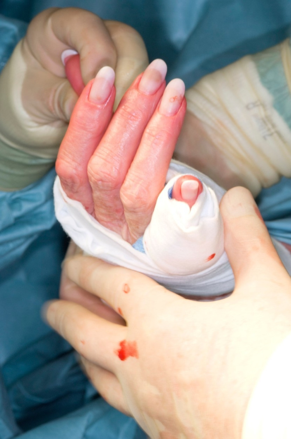 Radniku u Kuršumliji mašina umalo samlela ruku, SPASILA GA NJEGOVA HLADNOKRVNOST!