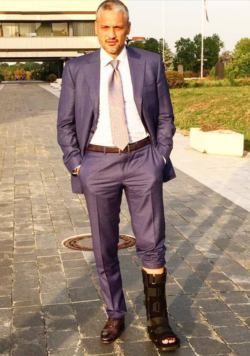 Čeda ide na „Paradu“ u gipsu?!