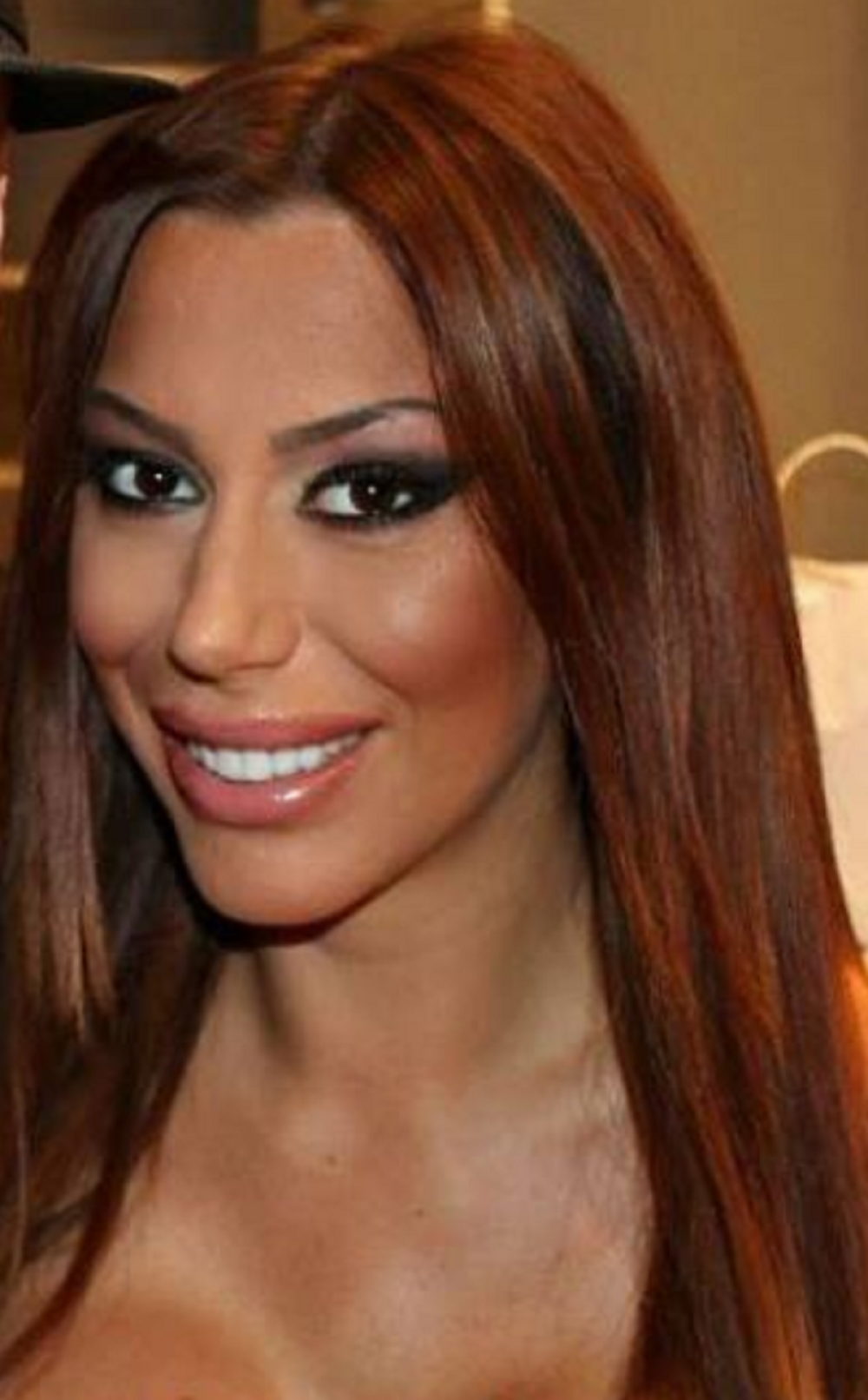 Mimi Oro pre i posle vađanja silikona iz usana!