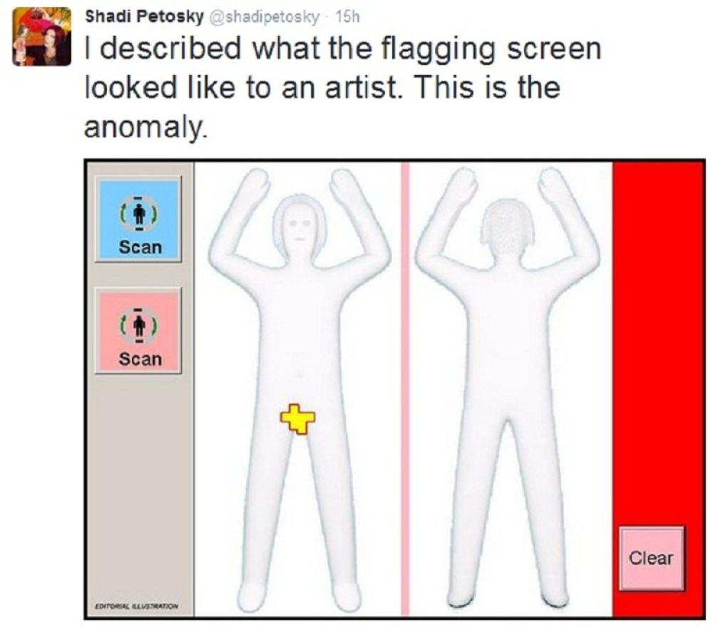 Transrodnu osobu maltretirali zbog penisa (FOTO)