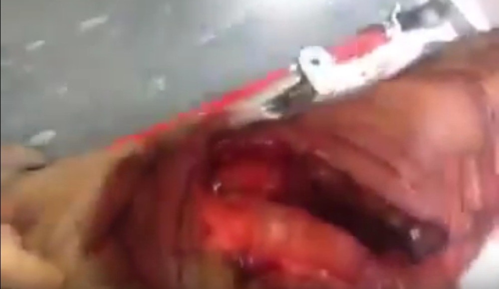 Pogledajte posledice napada ajkule (UZNEMIRUJUĆI VIDEO)