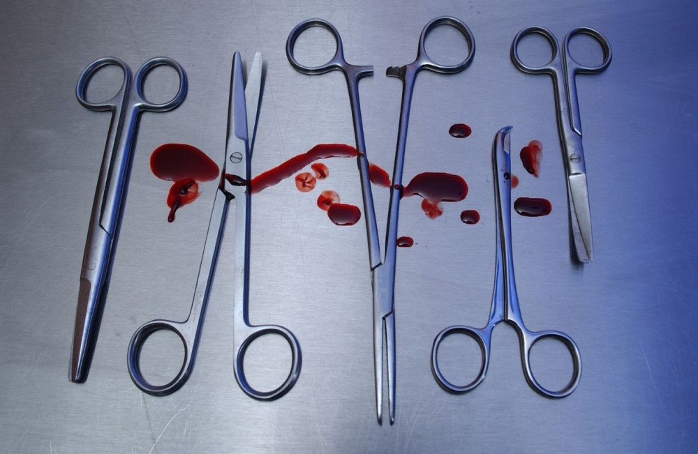 Frizer mušteriji odsekao deo uva