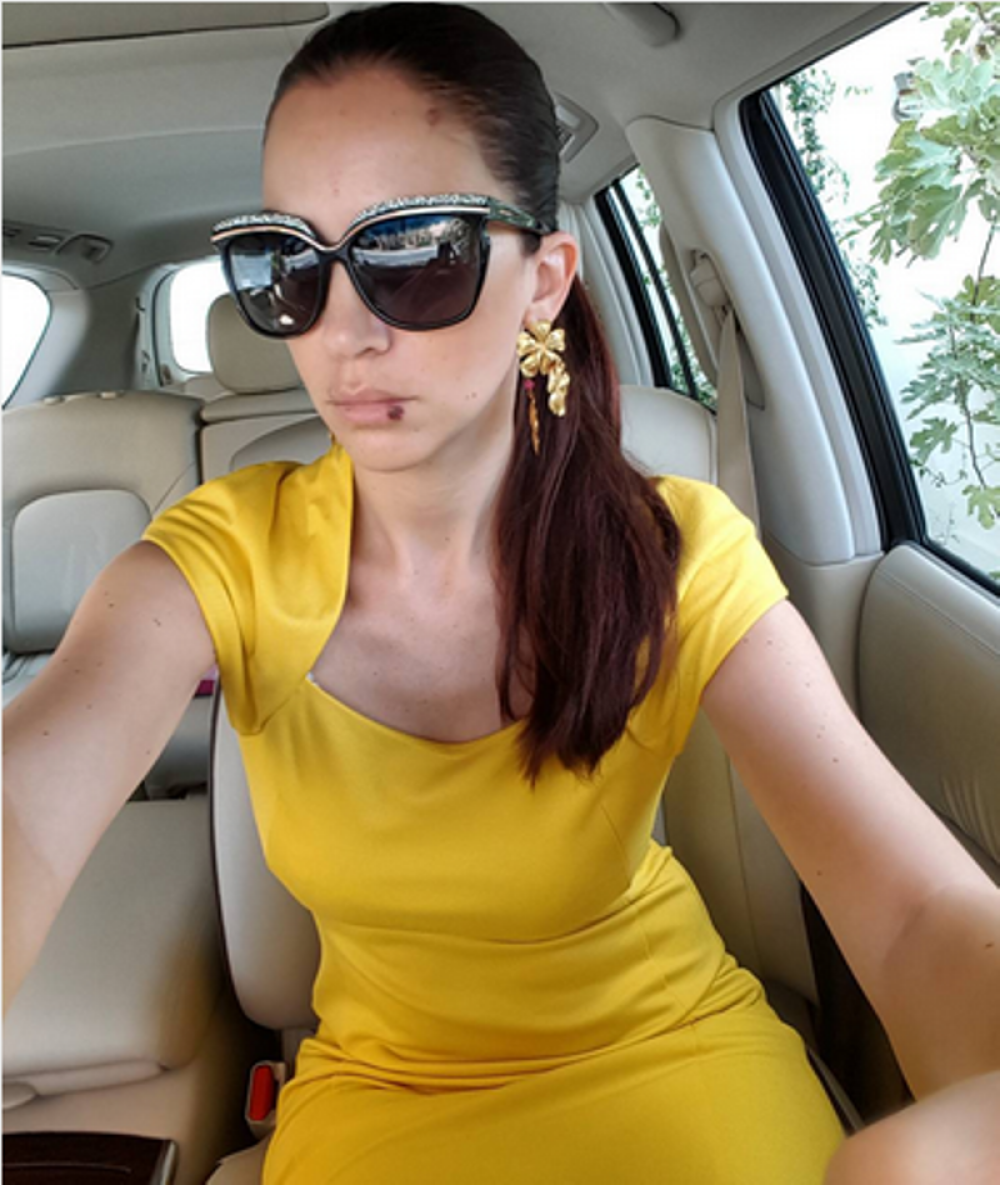 Jelenin selfi zaražen herpesom (FOTO)