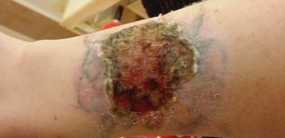 Ne pokušavajte ovo nikako! (UZNEMIRUJUĆI VIDEO)