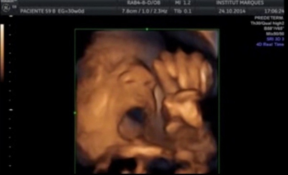 Beba peva u majčinom stomaku! (VIDEO)