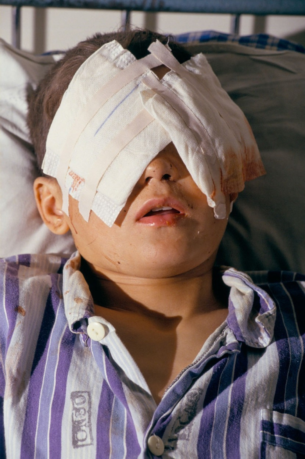 Iskopala dečaku oči pa se ubila