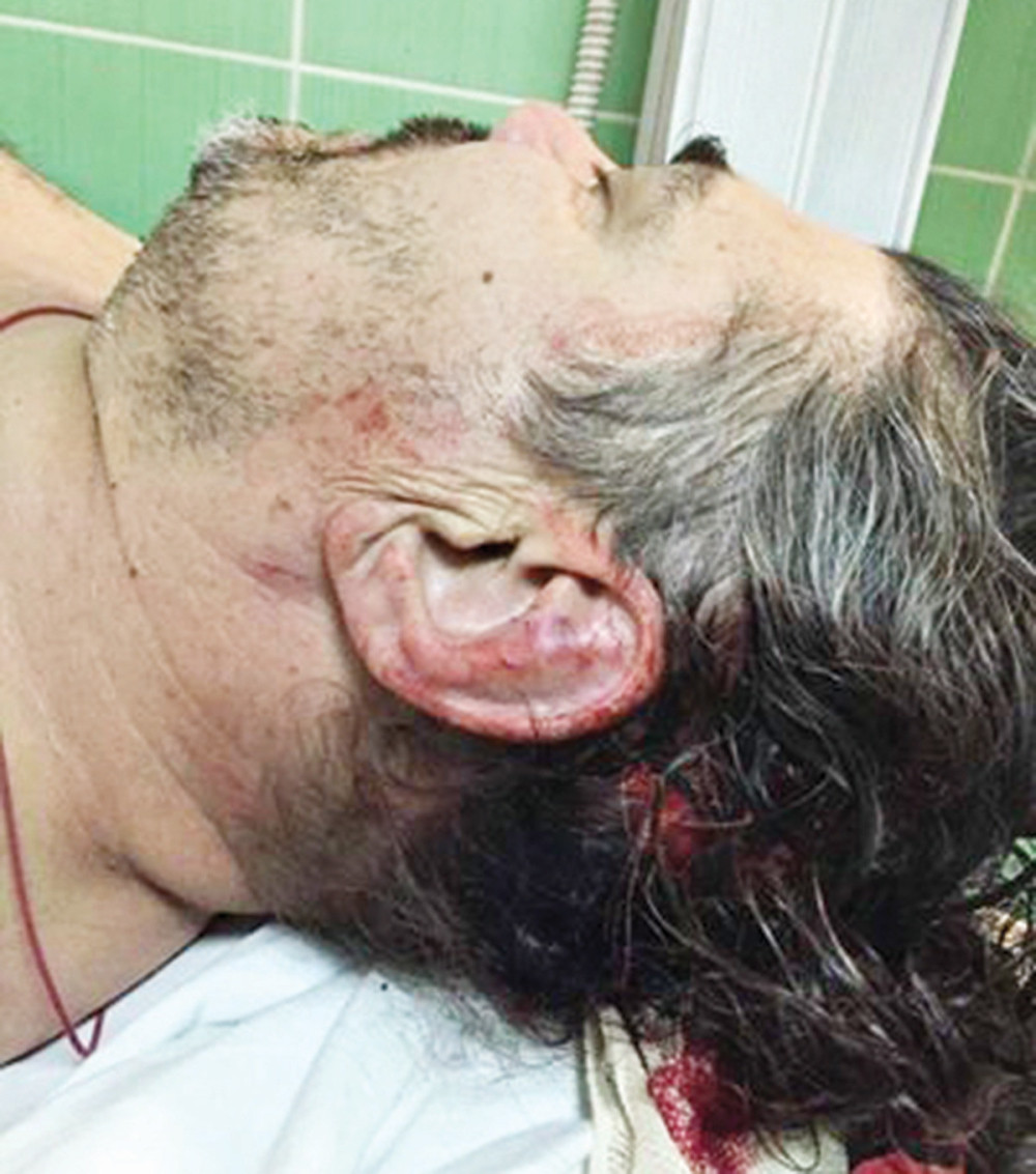 Odšeta za prebijanje 130.000 evra!