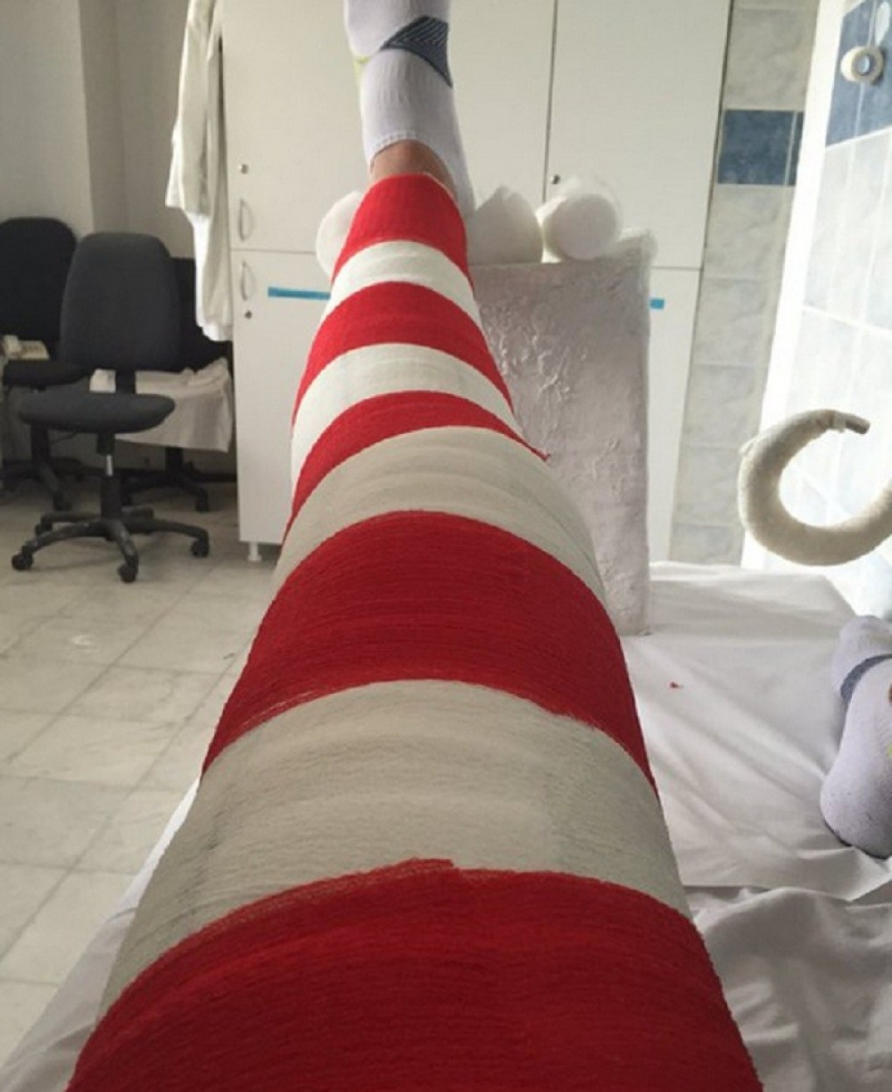 Luki Mitroviću stavili crveno-beli gips!