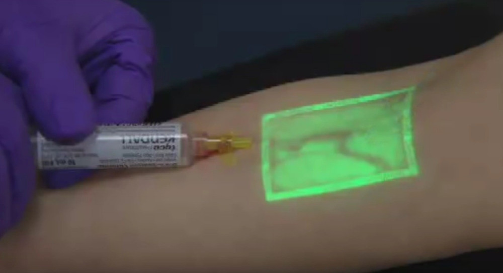 Ova sprava svaku venu nalazi iz prve! (VIDEO)