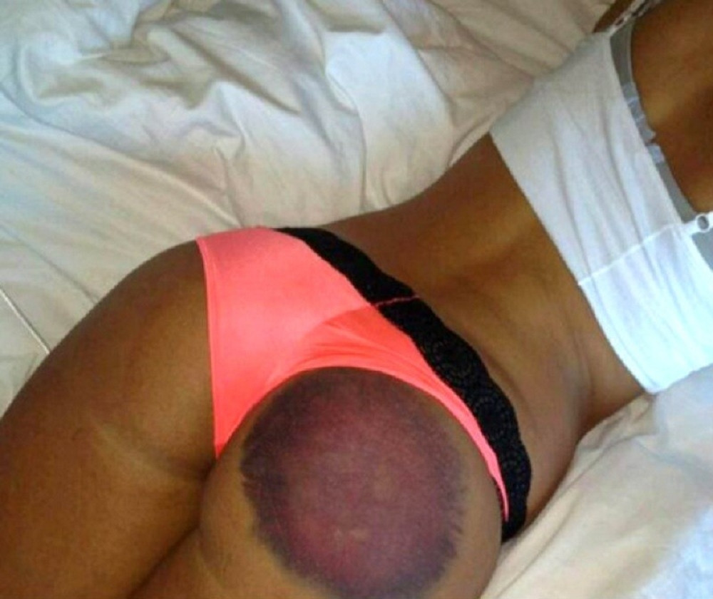 "Zečici" na bizaran način pomodrela guza! (VIDEO)