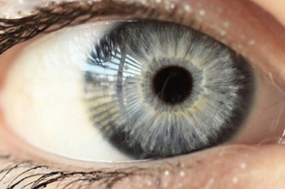 Ovaj svetski trend uzrokuje slepilo (FOTO)