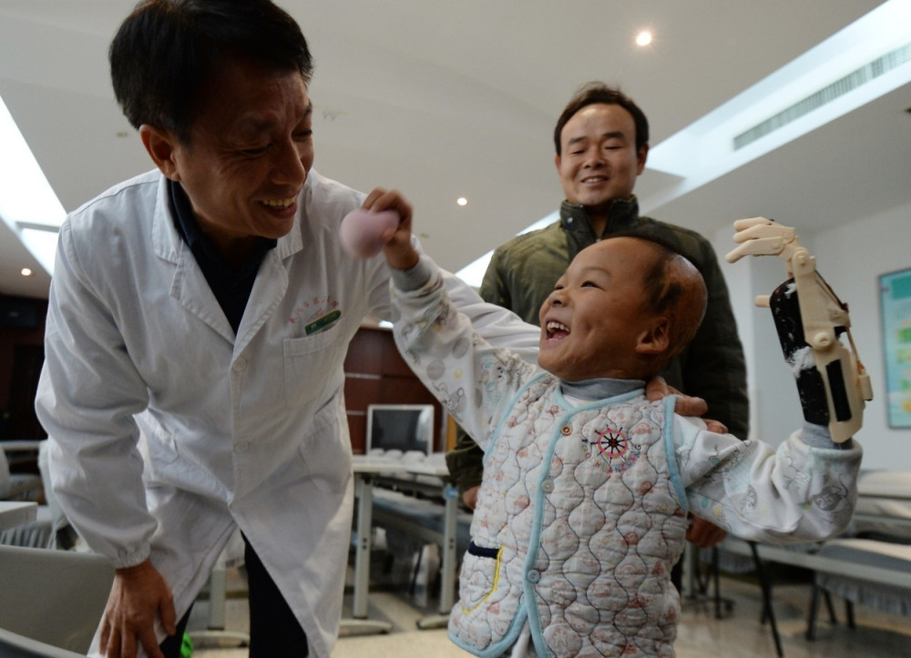 Dečaku odštampali novu ruku!