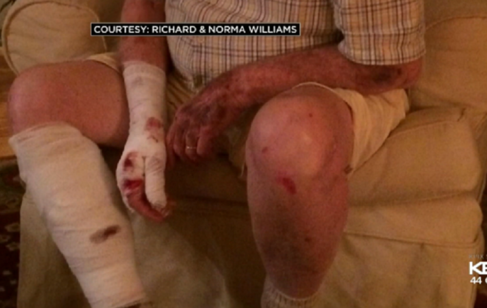 Zbog napada veverice završili u bolnici! (VIDEO)