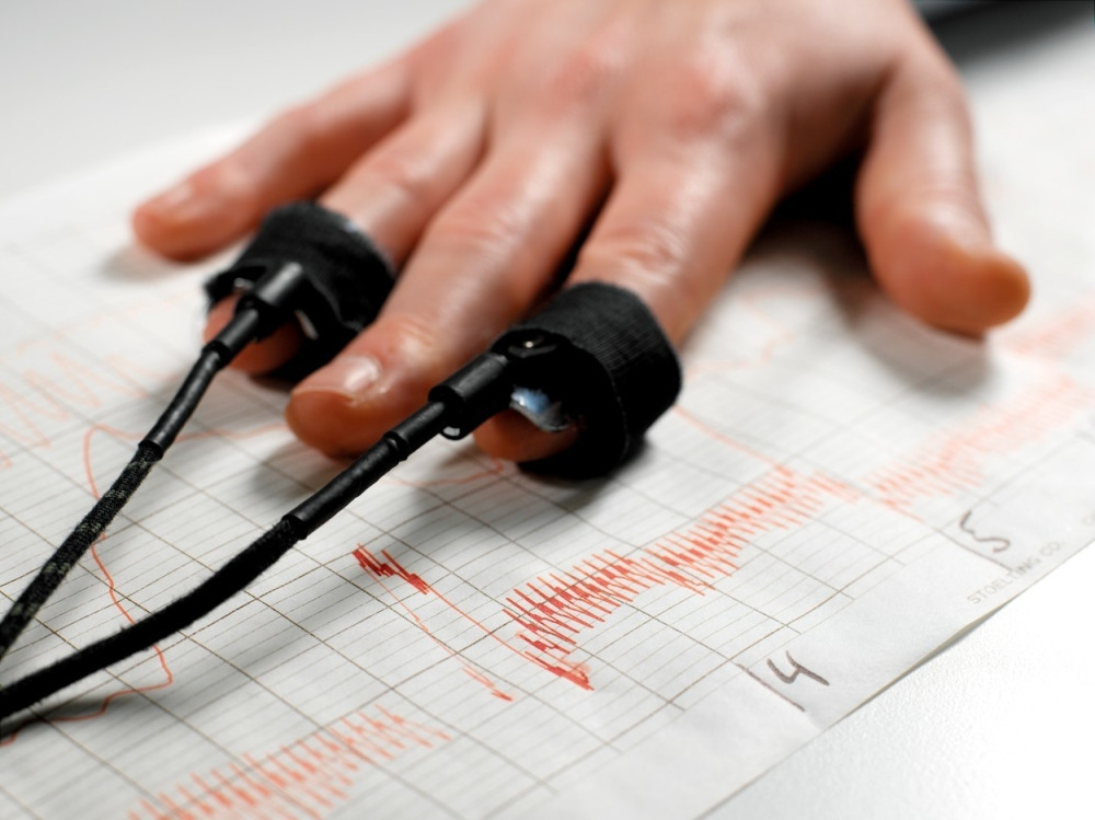 Socijalisti zovu naprednjake na poligraf