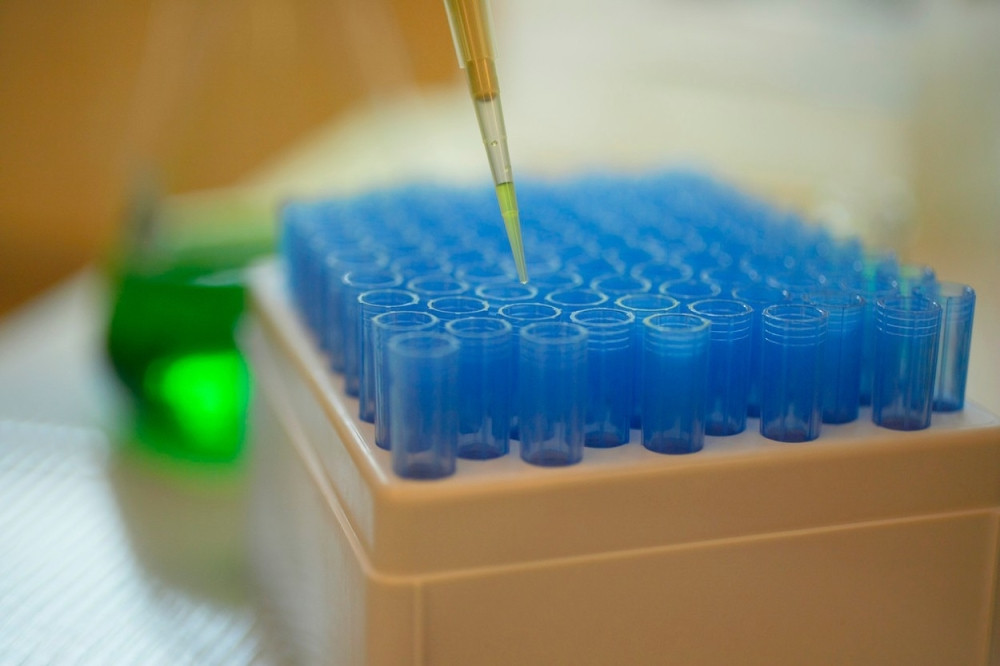 Ovo je najveća epidemija koju smo ikada imali na planeti, a mi nemamo načina da sprečimo širenje!