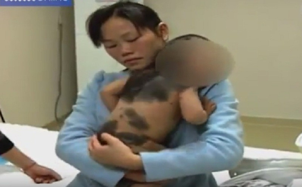 Bebcu rastu dlakavi mladeži od kojih se dobija rak (VIDEO)