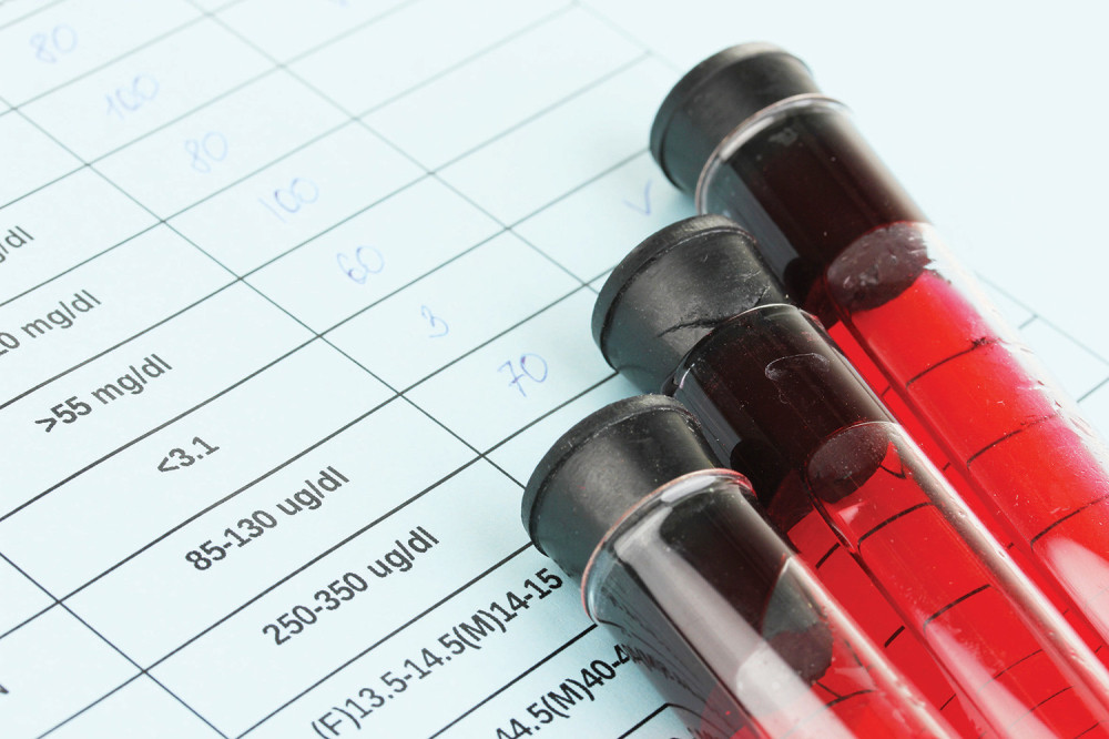 Otkrijte nedostatak gvožđa bez analiza!