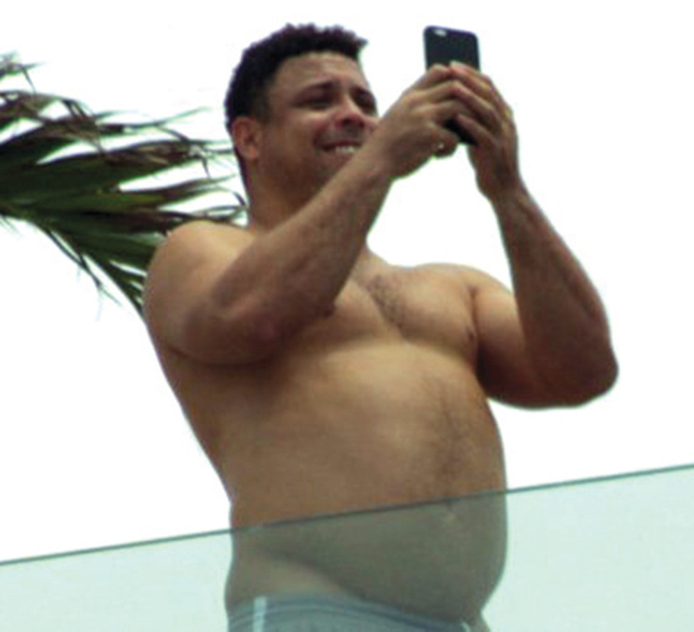 Zuba Ronaldo nikad deblji