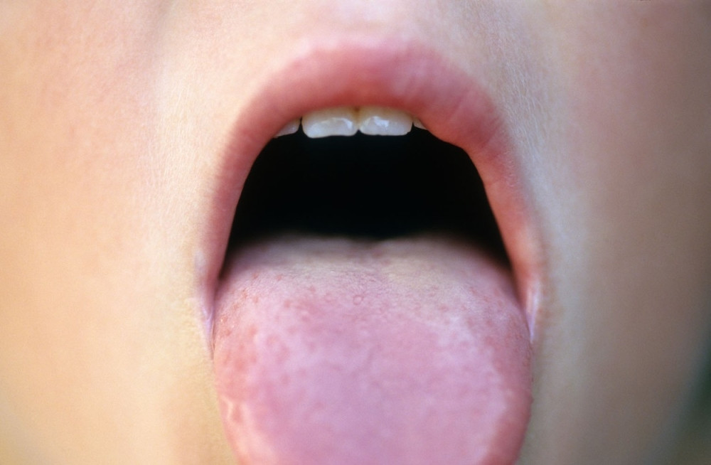 Znate li zašto se kaže "bez dlake na jeziku?"