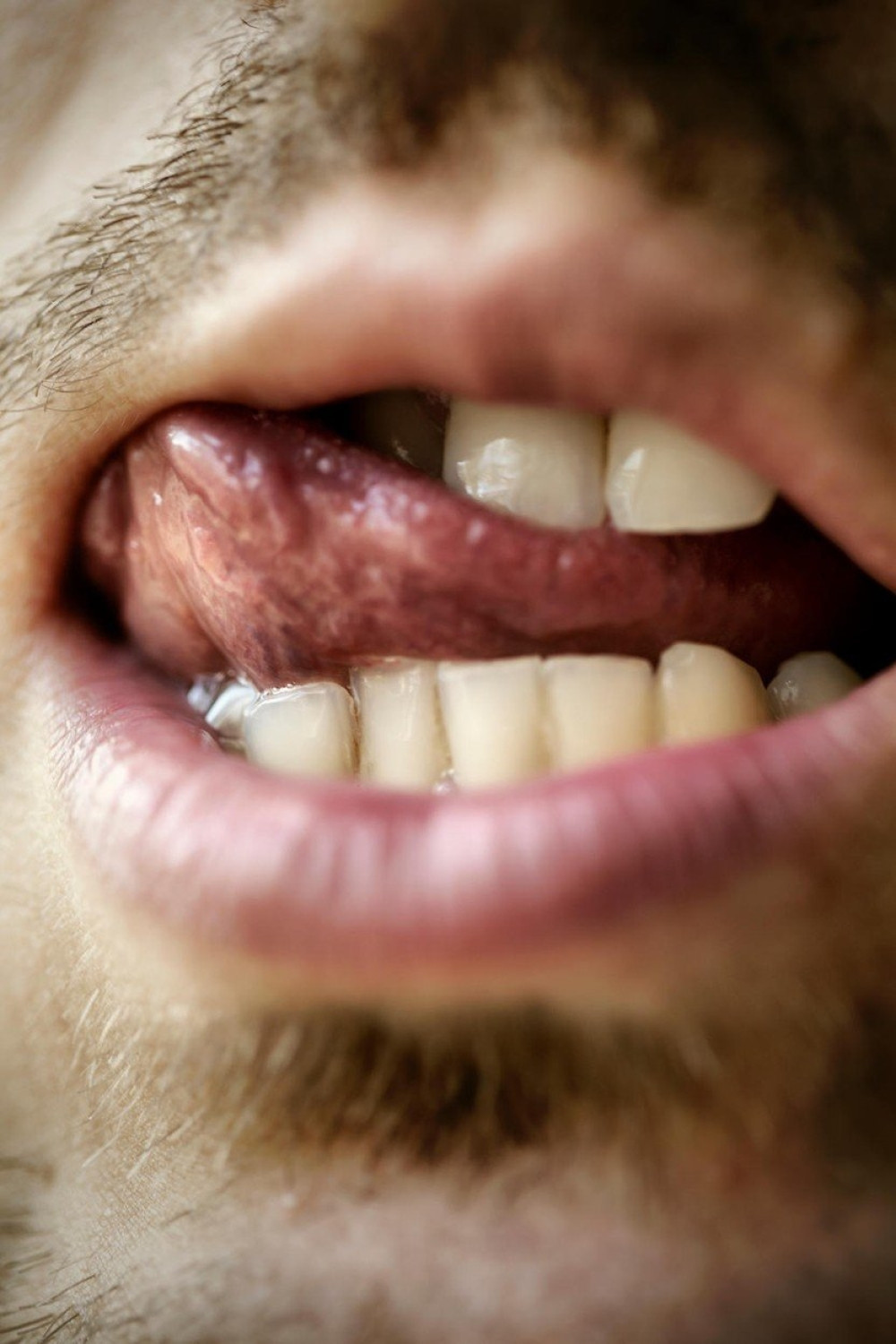 Usred Pariza uhapšeni kanibali!