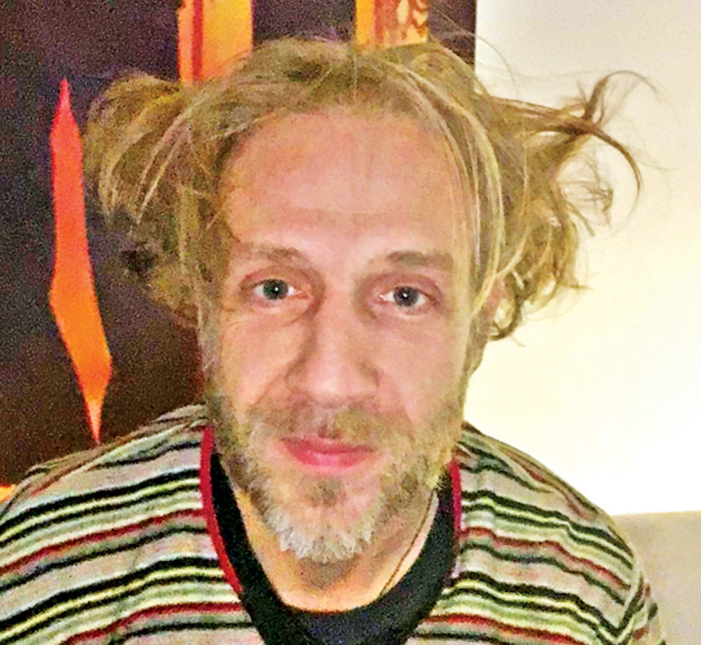 Milana Kalinića udarila struja