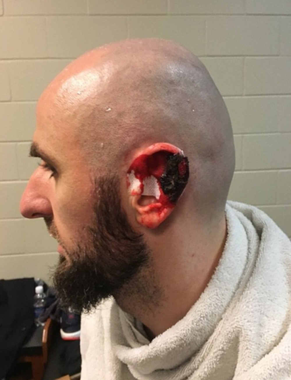 Crnogorac pocepao uvo protivničkom igraču (FOTO)