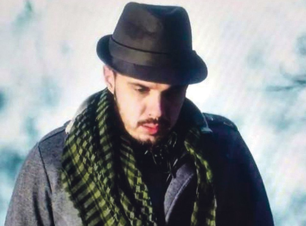 Pretučen pevač Bojan Tomović! Lice mu je UNAKAŽENO, završio u BOLNICI! (FOTO)