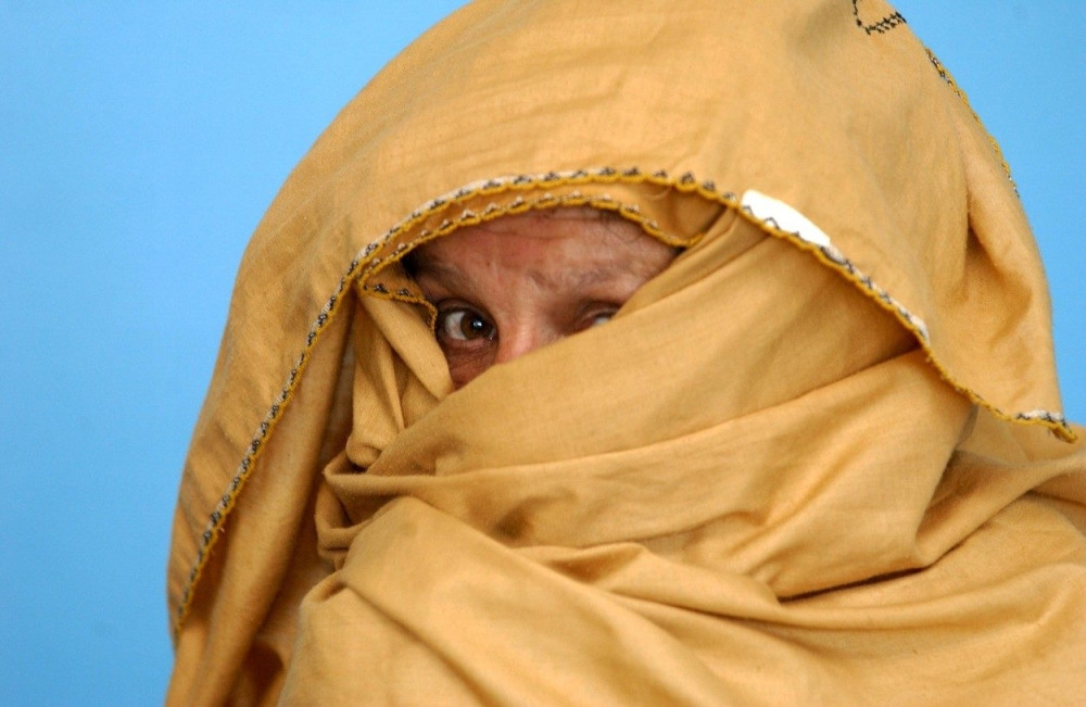 Ženi odsekao nos, pa pobegao u talibane