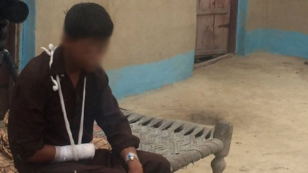 Dečak ne žali što je zbog imama sebi odsekao ruku!