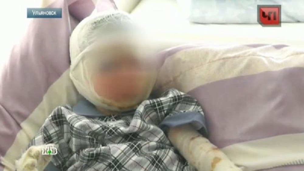 Zelenaši zapalili dečaka (2) iz osvete!