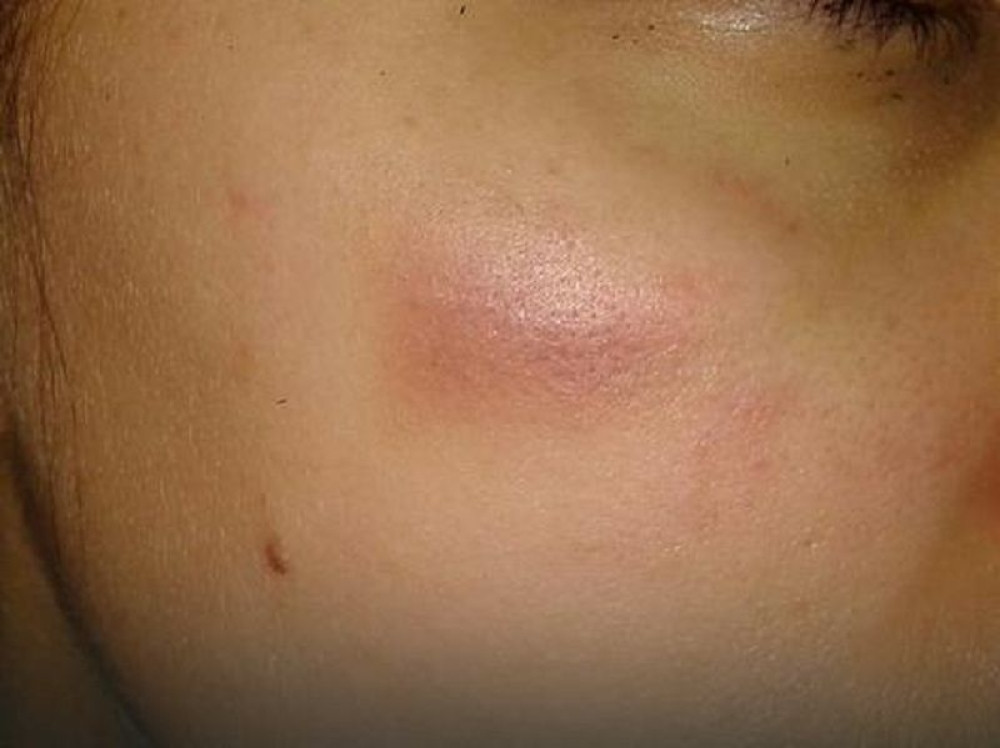 Pretukao devojku i poručio da će je opet naći