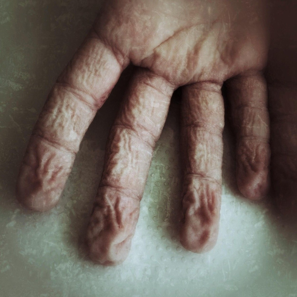 Zašto se prsti smežuraju u vodi?