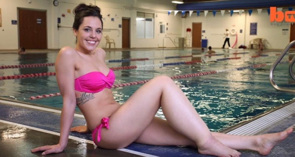 Htela da se ubije zbog noge, a sada je fotomodel! (VIDEO)