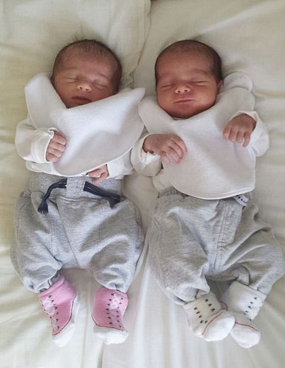 Na porođaju saznala da nosi bliznakinje spojene glavama! (FOTO)