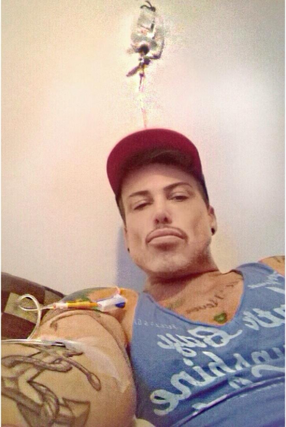 Hteo da ulepša nos, a stradao mu polni organ